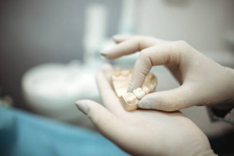 Dantų implantacija: modernūs sprendimai ir ką verta žinoti prieš procedūrą